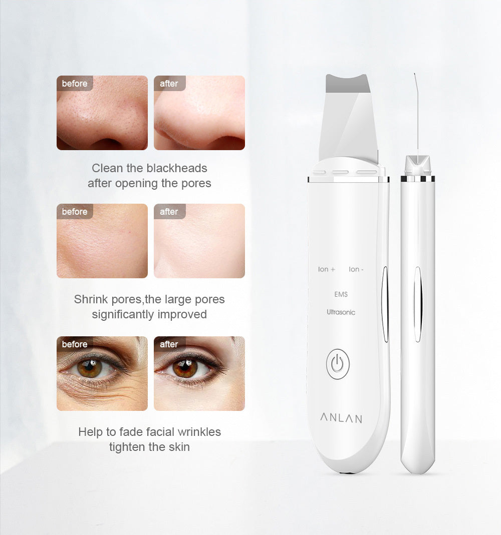 Ultrasonic Skin Scrubber Deep Face Cleaning Machine Peeling Shovel Facial Pore Cleaner Face Skin Scrubber Lift Machine - Mama Lifestyles