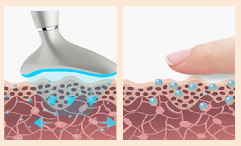 Neck Beauty Instrument To Remove Nasolabial Lines And Neck Lines Massage To Lift The Face - Mama Lifestyles