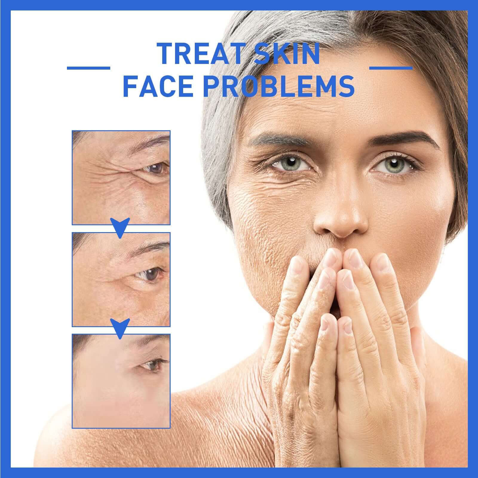 Anti-wrinkle firming head lifting pattern for smoother skin