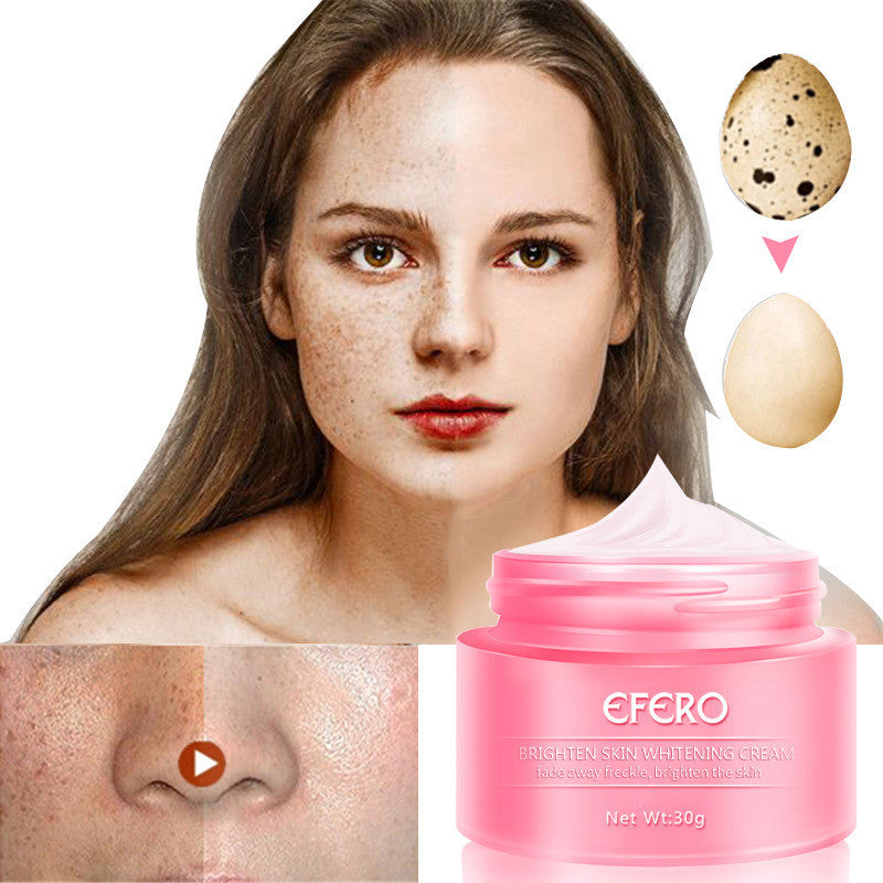 Efero freckle cream - Mama Lifestyles