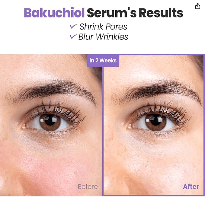 Bakuchiol Serum - Mama Lifestyles