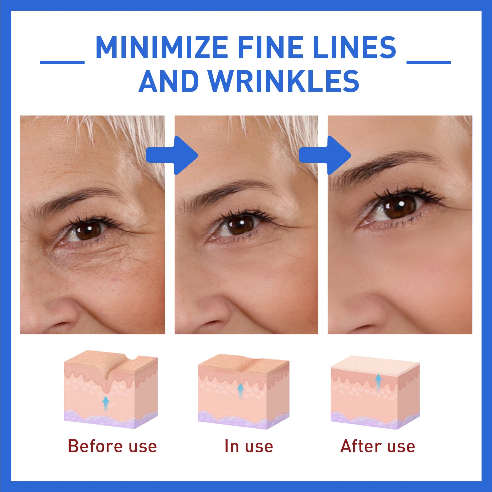 Anti-wrinkle firming head lifting pattern for smoother skin