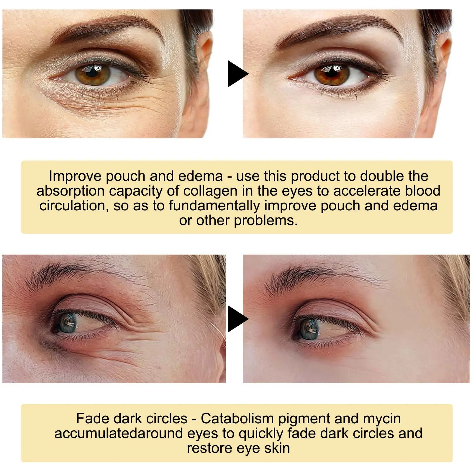 Eye Mask Fade Eye Bags Firming And Hydrating Moisturizing - Mama Lifestyles