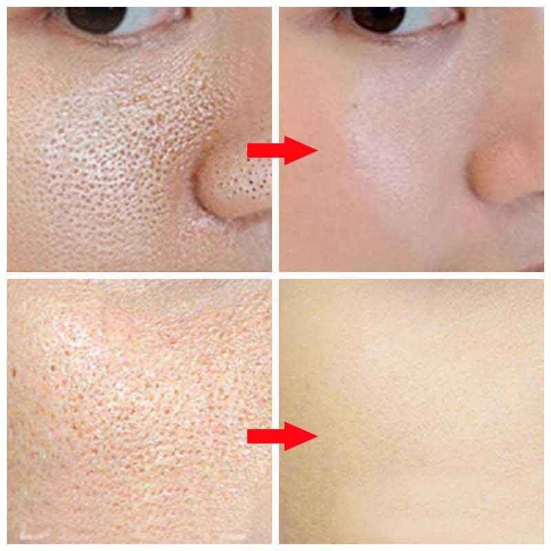 Pore Refining Serum - Mama Lifestyles