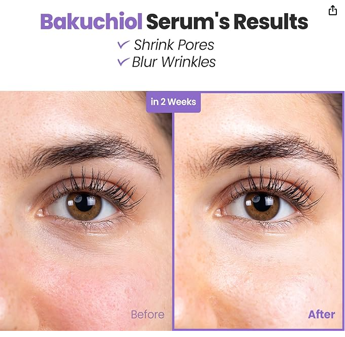 Bakuchiol Serum