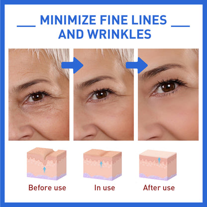 Anti-wrinkle firming head lifting pattern for smoother skin