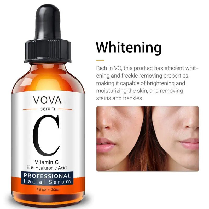 Vitamin C Serum Facial Serum Amazon - Mama Lifestyles