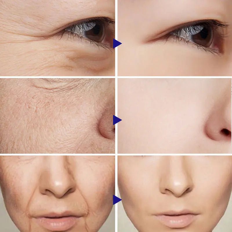 Vitamin C Serum Facial Serum Amazon - Mama Lifestyles