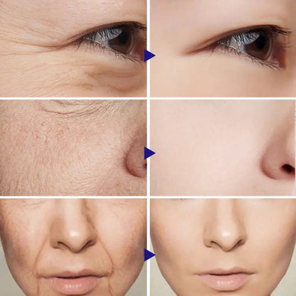 Vitamin C Serum Facial Serum Amazon - Mama Lifestyles